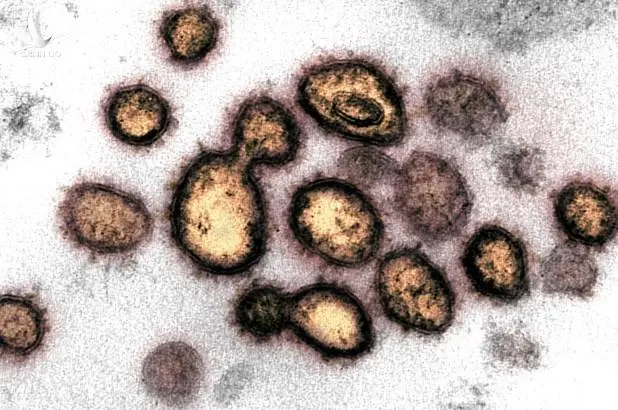 Biến chủng SARS-CoV-2 đe dọa nỗ lực điều chế vaccine
