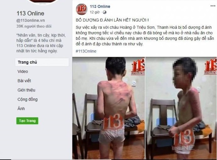 Cháu bé nghi bị bố dượng hành hung tại Thanh Hóa: Clip cắt ghép từ mạng Trung Quốc